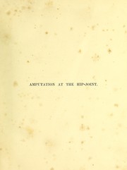 Cover of: History of a successful case of amputation at the hip-joint: (the limb 48 inches in circumference, 99 pounds weight)