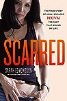 Scarred by Sarah  Edmondson