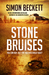 Stone Bruises by Simon Beckett