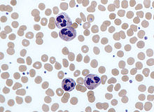 Neutrophils.jpg