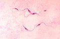 Trypanosoma cruzi crithidia (Euglenozoa, Trypanosomatidae)