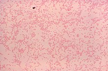 Gram-stained photomicrograph depicting numerous Gram-negative "Brucella canis" bacteria