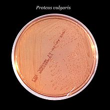 Plate with an active bacterial culture