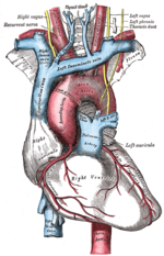 Thumbnail for Congenital stenosis of vena cava