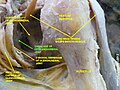 Dissection image of cartilage of glenohumeral joint in green.