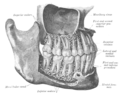 Denture permanente.