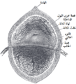 صورة داخلية للمثانة.