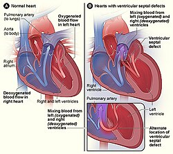 VSD image.jpg