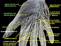 Adductor pollicis muscle