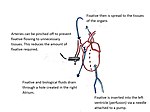 Thumbnail for File:Perfusion Diagram.jpg