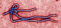 Image 2Foto virion virus ebola dalam mikroskop transmisi elektron yang telah diwarnai. Oleh: Cynthia Goldsmith dari CDC. (from Portal:Virus/Gambar pilihan)